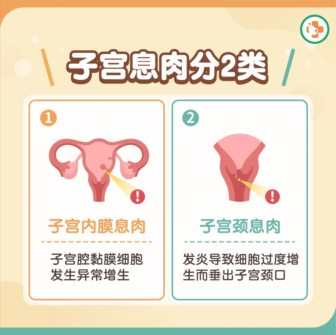 子宫息肉分为子宫内膜息肉及子宫颈息肉