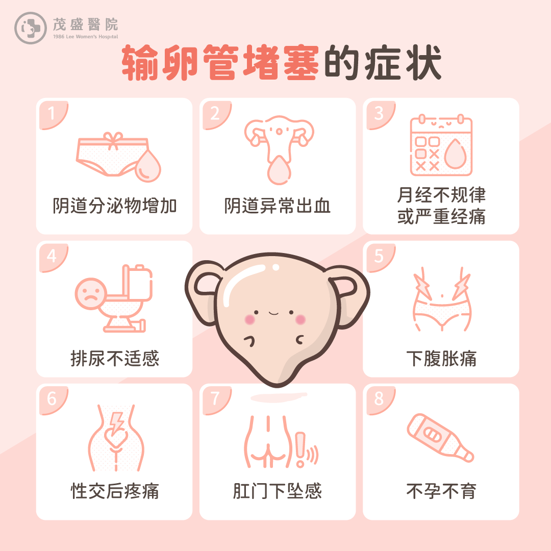 输卵管堵塞8症状检核