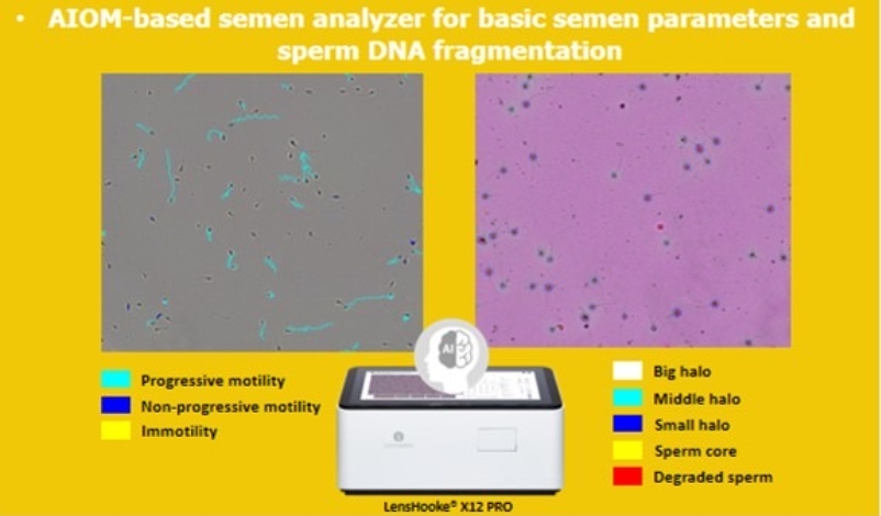 人工智慧光学显微镜（AIOM）精液分析仪呈现的精液参数及精虫DNA碎片程度