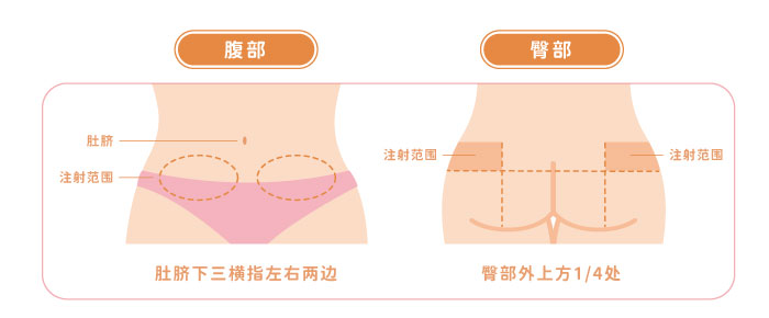 促排卵针注射位置