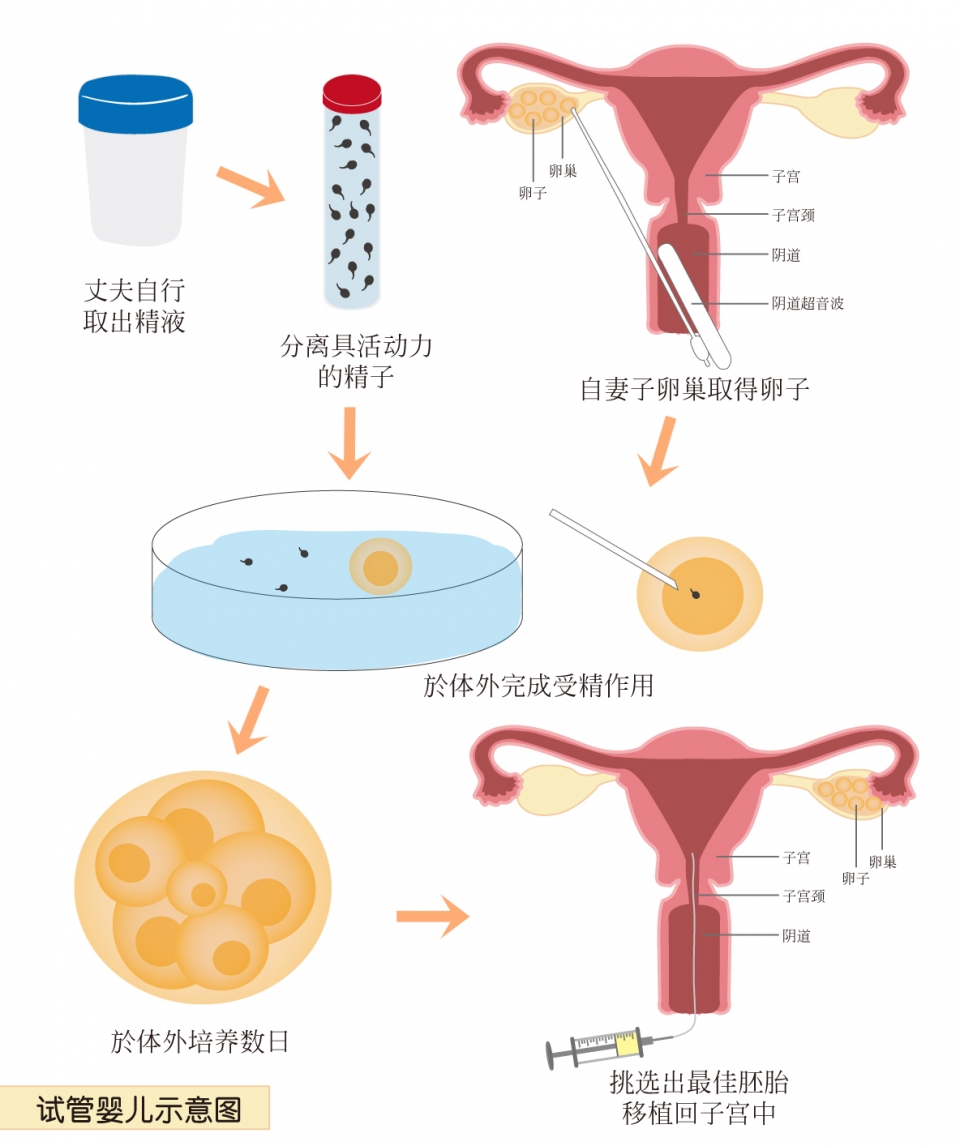 (簡)試管嬰兒示意圖