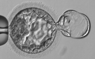 vacuoles(-) vacuoles(-)