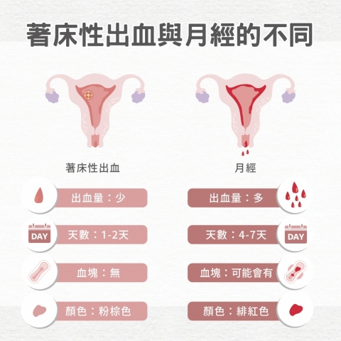 怀孕着床出血与月经的分别 怀孕着床出血与月经的分别